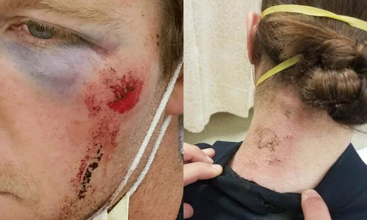 seattle police injuries