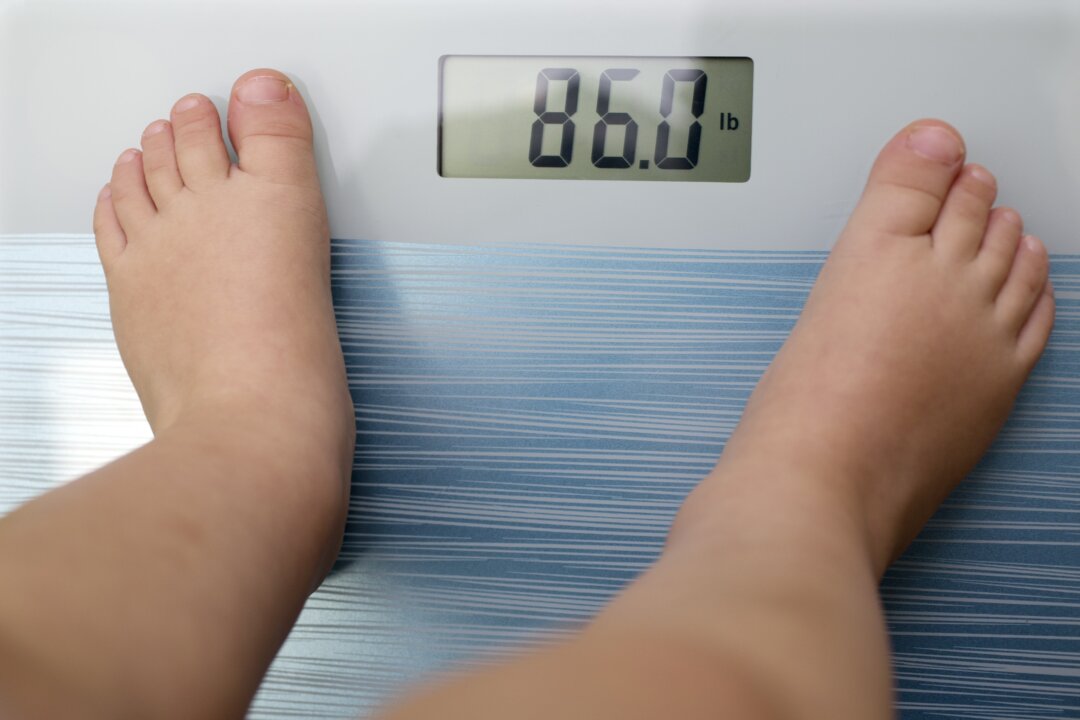 In the United States, childhood obesity has become a larger risk factor for multiple sclerosis than smoking. (off5173/Shutterstock)