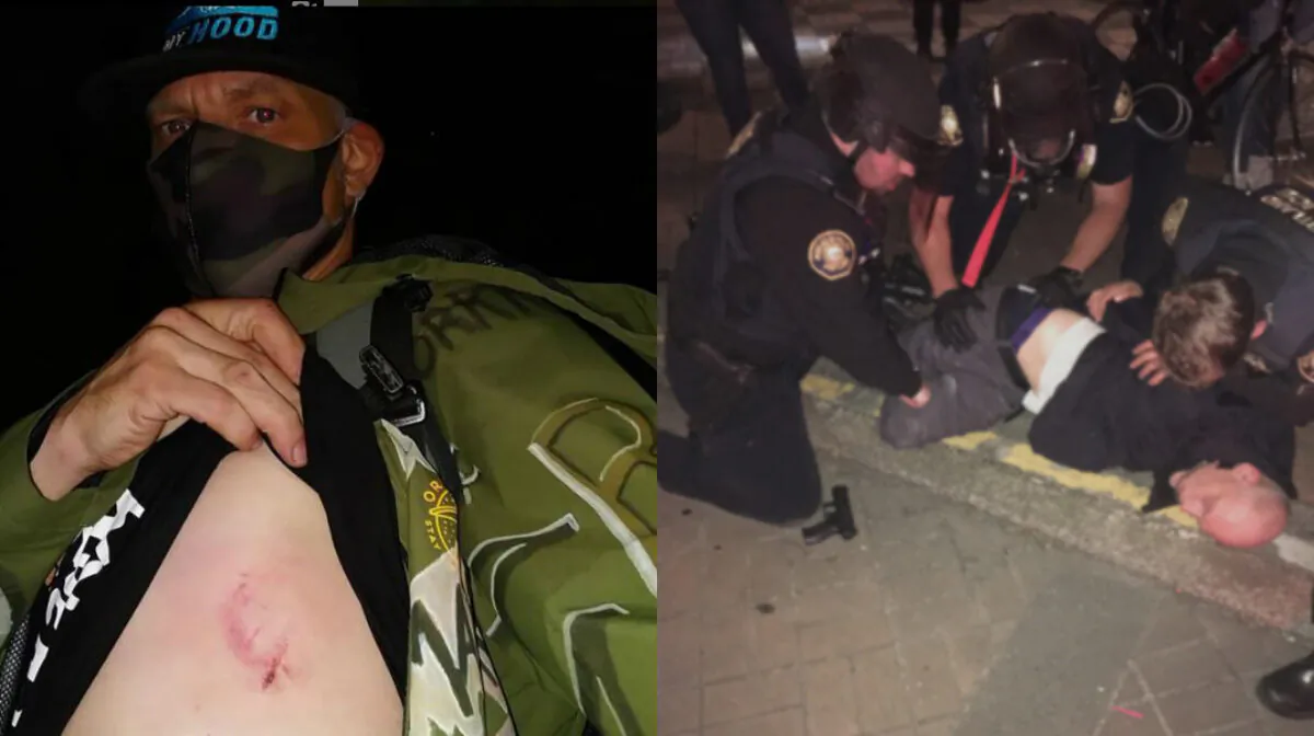 Michael Reinoehl, left, in a selfie photograph, showcasing what he said was a wound from being hit with a beanbag fired by police officers, in Portland, Ore., on July 3, 2020. On right, a man later identified as Reinoehl in court records is arrested in Portland, Ore., early July 5, 2020. (michael_reinoehl/Instagram; Portland Police Bureau) 
