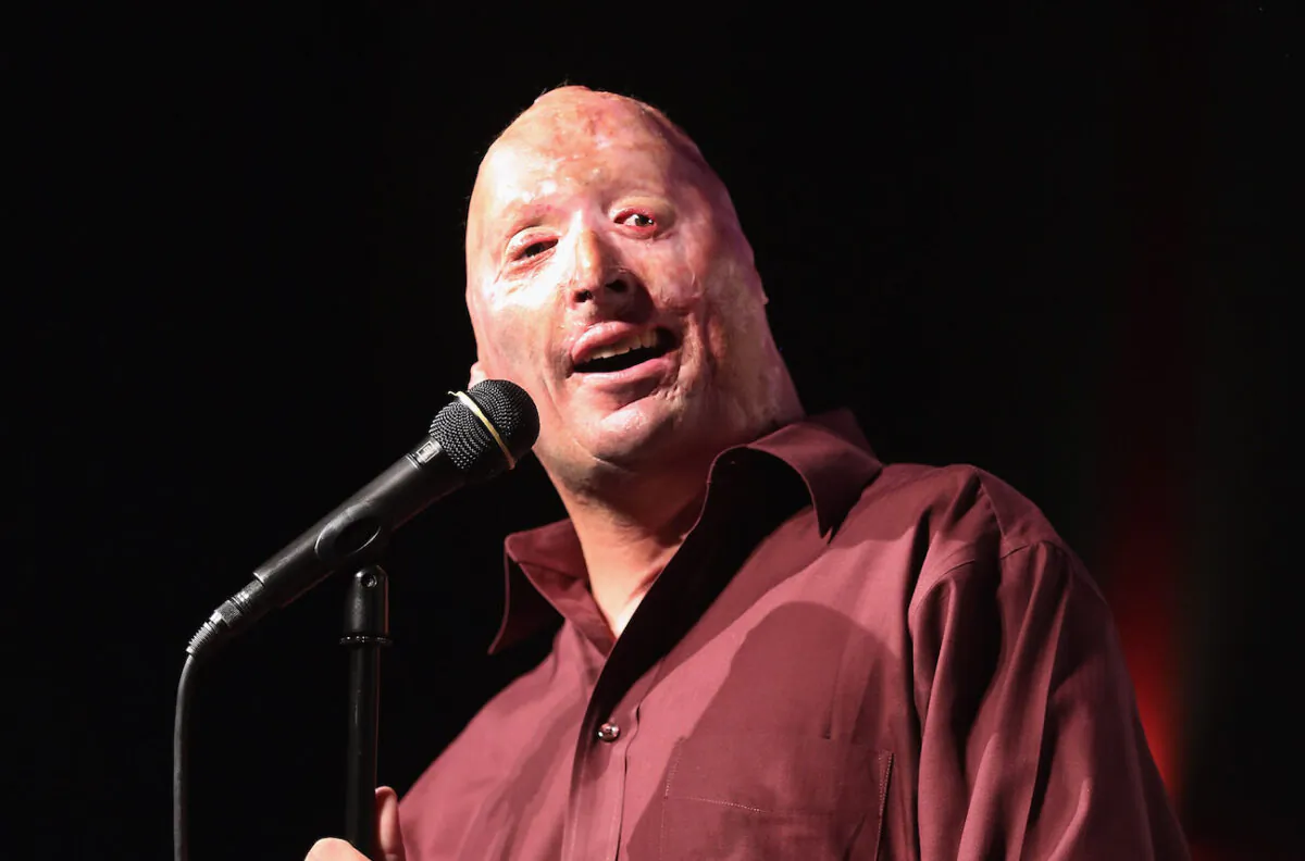 Comedian and wounded U.S. Army veteran Bobby Henline performs at the "Humor For Heroes" charity event at the Laugh Out Loud Comedy Club in San Antonio, Texas, on Aug. 9, 2012. (John Moore/Getty Images)