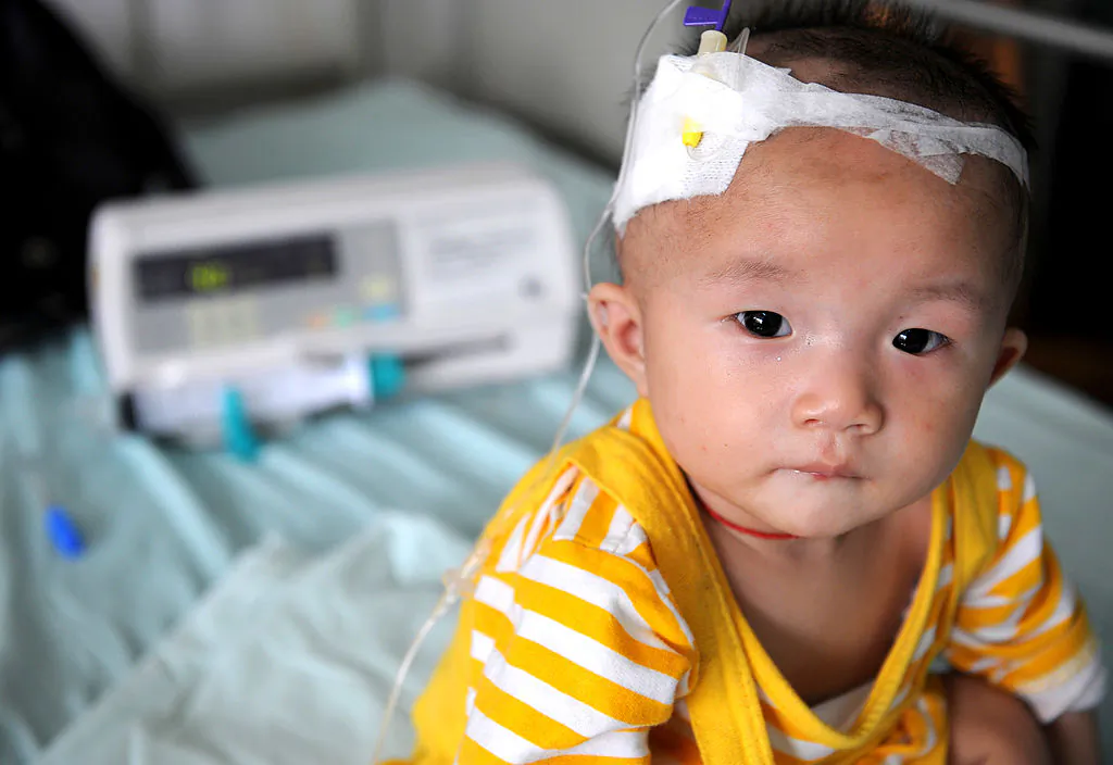 A baby who suffers from kidney stones after drinking tainted milk powder, gets IV treatment at the Chengdu Children's Hospital in China's Sichuan Province, on Sept. 22, 2008. (China Photos/Getty Images)