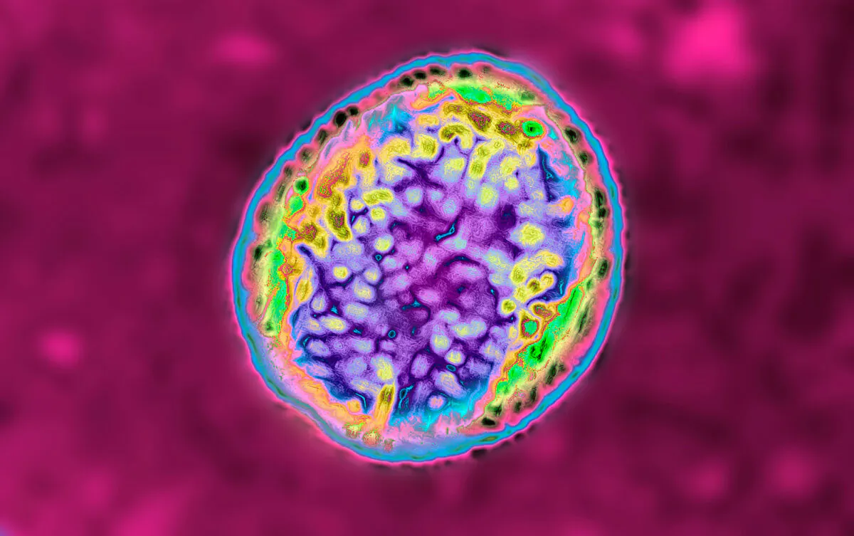 The Brucella bacterium responsible for brucellosis or Malta fever. Optical microscope view. (BSIP/Education Images/Universal Images Group via Getty Images)