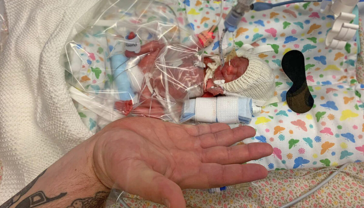 Baby Born Smaller Than Her Dad’s Hand and Given 10 Percent Chance of ...