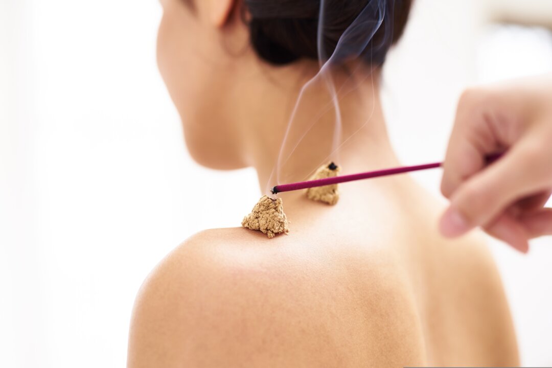 A combination of acupuncture and moxibustion therapy was found to be superior in treating sudden deafness as compared with the routine drug-based therapy. (number-one/Shutterstock)