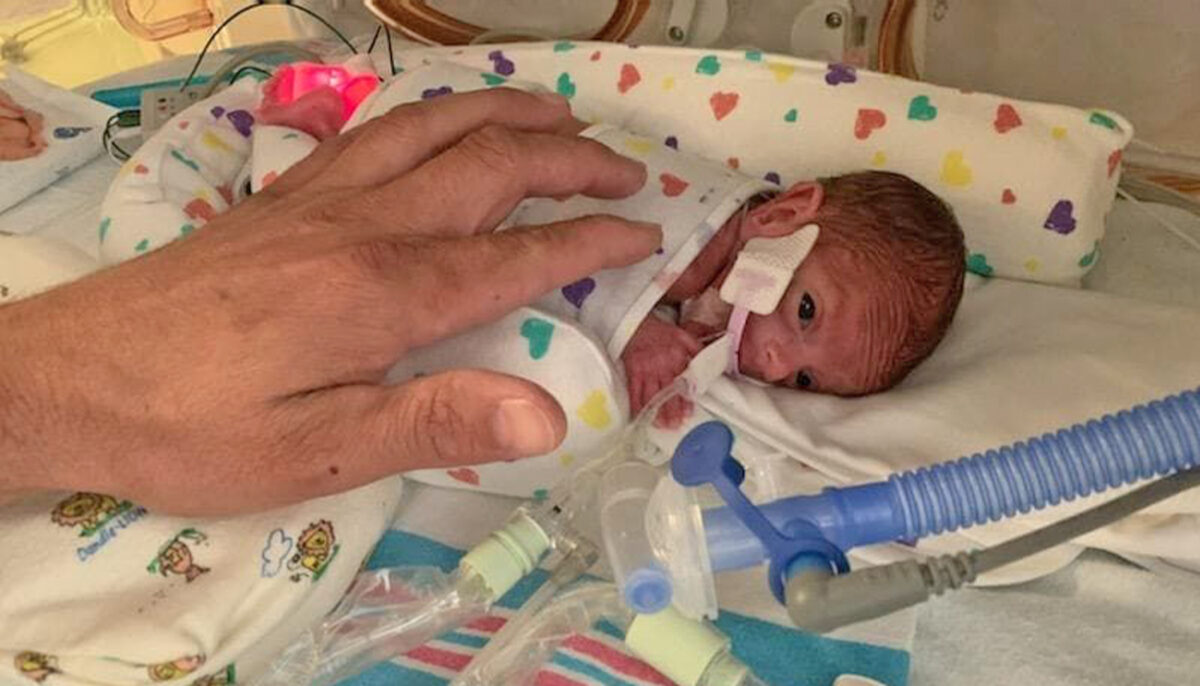 One Pound Micro Preemie Born At 22 Weeks Goes Home After 133 Days In Nicu