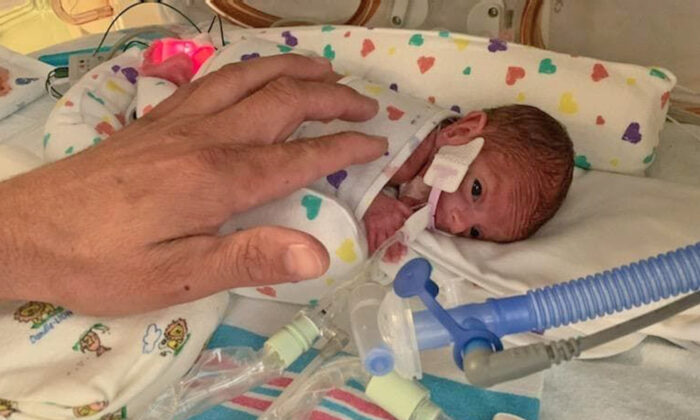 One-Pound ‘Micro-Preemie’ Born at 22 Weeks Goes Home After 133 Days in