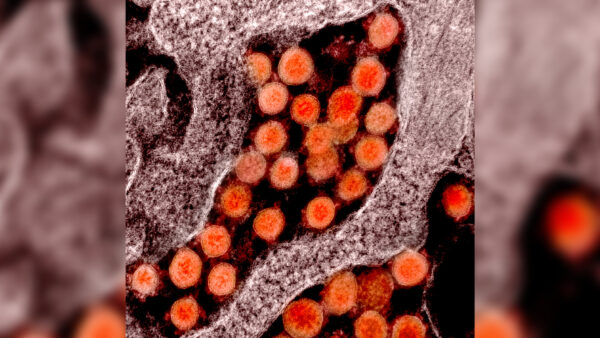 Particles of the CCP Virus