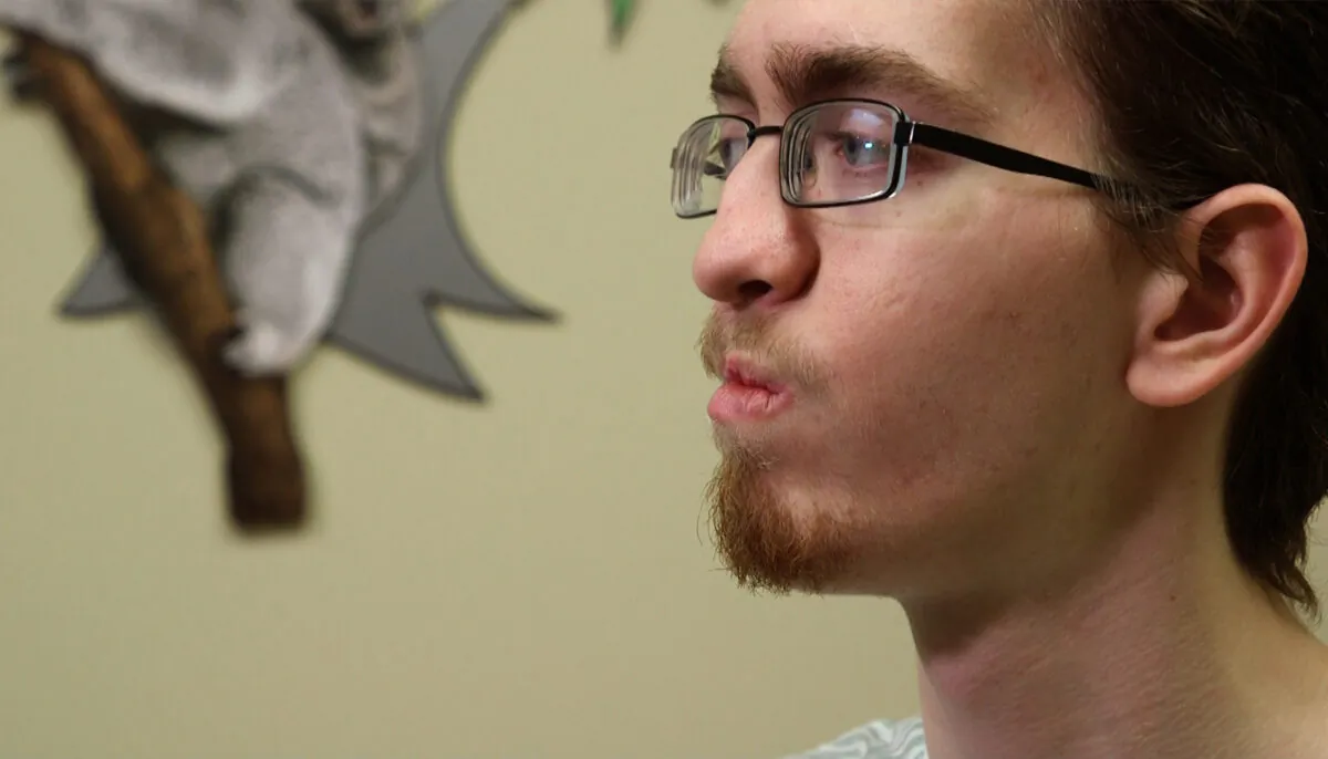 David Bufkin, 20, of Sun City, Arizona, was born with a cleft palate didn’t speak until almost the age of three. (Courtesy of Banner Health)