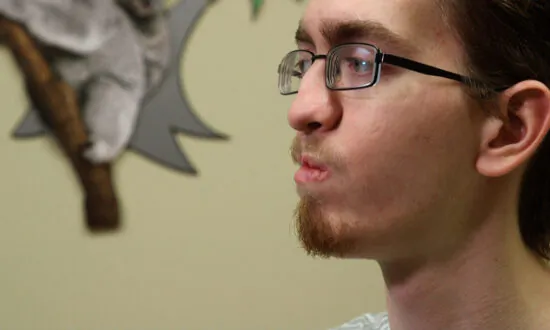 Groundbreaking Cleft Palate Surgery Changes 20-Year-Old Patient’s Life