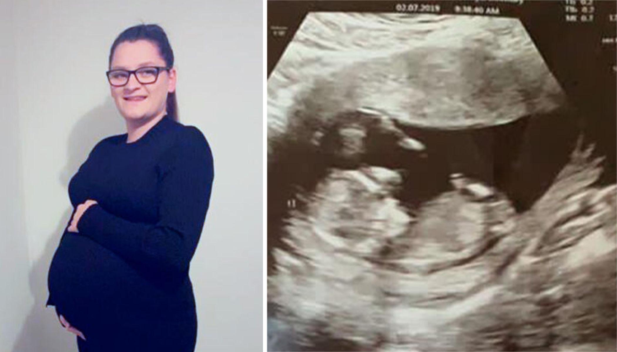 Pregnant Mom Carries Dead Unborn Baby for 10 Weeks to Give Twin ...