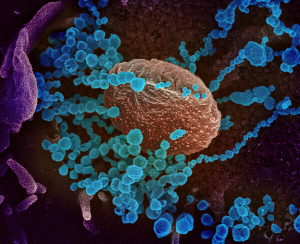 microscope image CCP virus