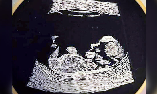 Blind Father-to-Be Can’t See Ultrasound Image–so Friend Embroiders Scan for Him to Feel