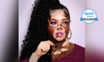 Woman With Vitiligo Was Mocked, but Became a Model, Urges: ‘It Doesn’t Matter What They Think’