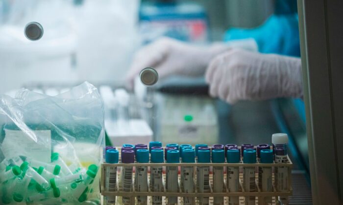 A medical staff prepares and processes PCR and antibody tests of people who think they may be infected with COVID-19, at the laboratory of Karolinska Hospital in Solna near Stockholm, on Dec. 7, 2020. (Jonathan Nackstrand/AFP via Getty Images)