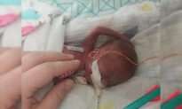Baby Born at 21 Weeks Defies the Odds, Becomes One of the Youngest Babies to Survive
