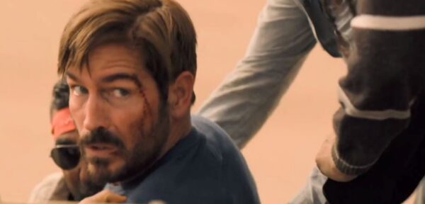man with wounded face looking over shoulder
