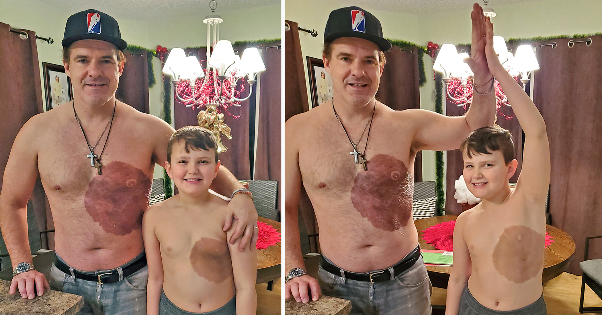 Dad Endures 30-Hour Tattoo, Surprises Son With Replica Birthmark to Boost His Confidence - Vimarsana News