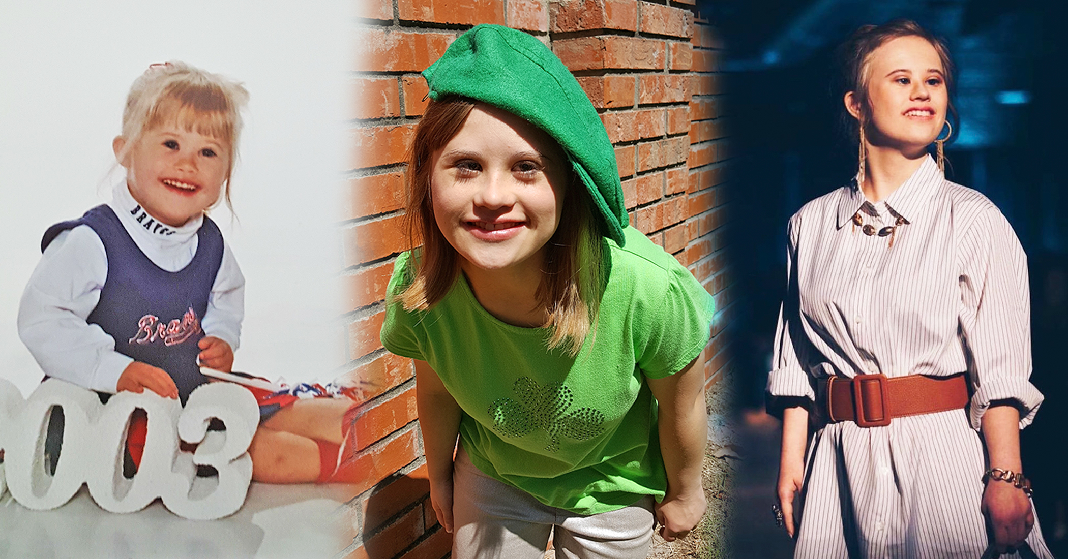Girl With Down Syndrome Was Told She Had 'Failure to Thrive,' Defeats Obstacles, Helps Others - Vimarsana News