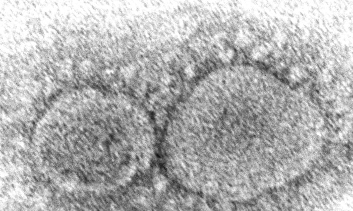 This 2020 electron microscope image shows SARS-CoV-2 virus particles which cause COVID-19. (Hannah A. Bullock, Azaibi Tamin/CDC via AP)