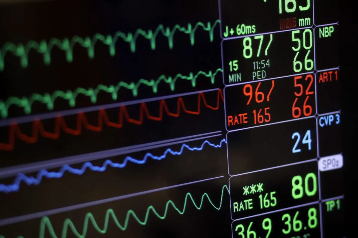A screen displays a patient's vital signs during open heart surgery at the University of Maryland Medical Center in Baltimore on Nov. 28, 2016. Some experts fear that legislation intended to make it easier for intolerably suffering Canadians to receive medical assistance to end their lives might actually make it harder in some cases and will create confusion among doctors who provide the procedure. (Patrick Semansky/The Canadian Press/AP)