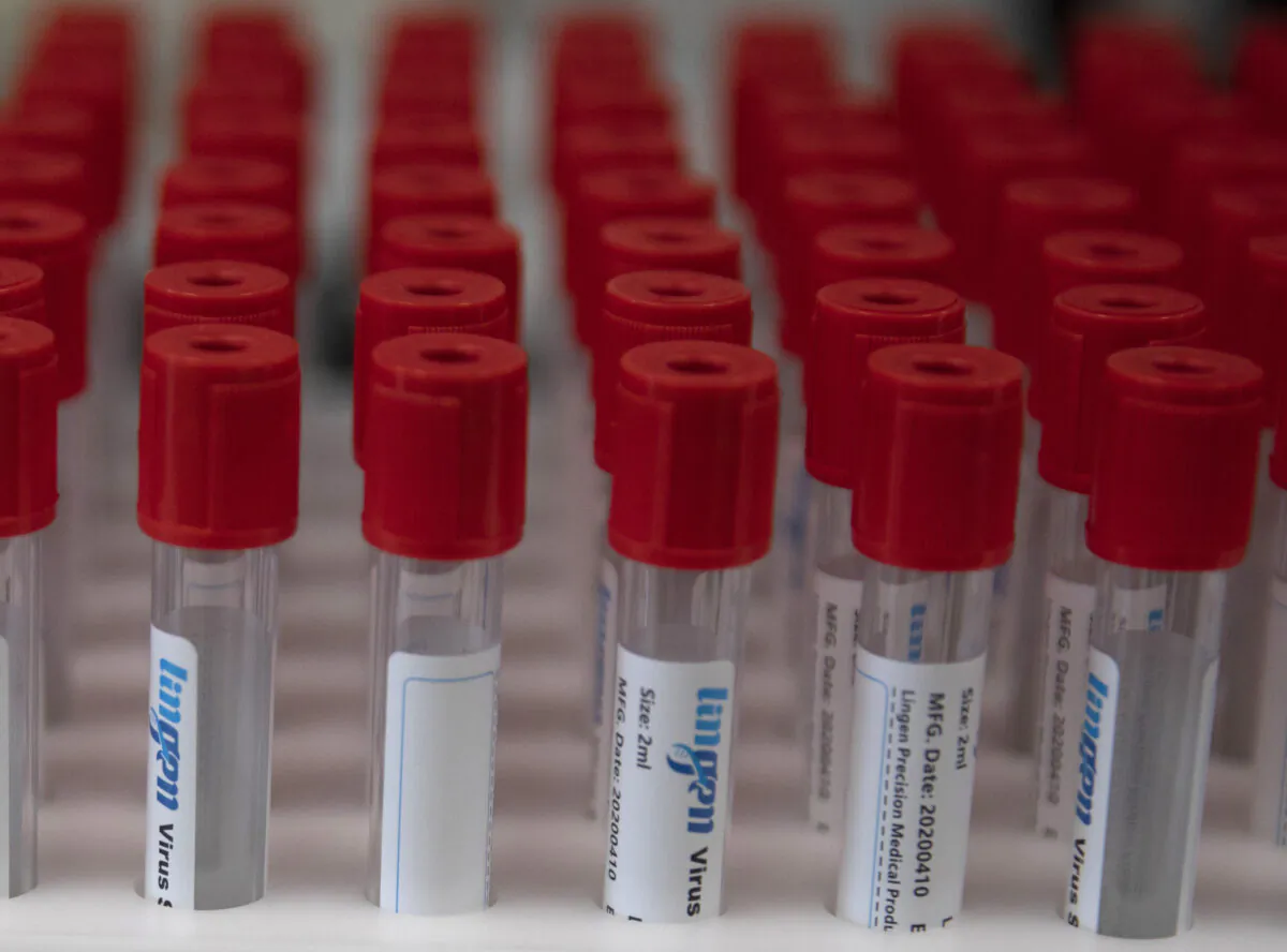 A case of test tubes is placed on a lab table during research on coronavirus, COVID-19, at Johnson & Johnson subsidiary Janssen Pharmaceutical in Beerse, Belgium, Wednesday, June 17, 2020. Janssen Pharmaceutical hopes to begin clinical trials on a potential vaccine for COVID-19 in the middle of the summer. (Virginia Mayo/AP Photo)