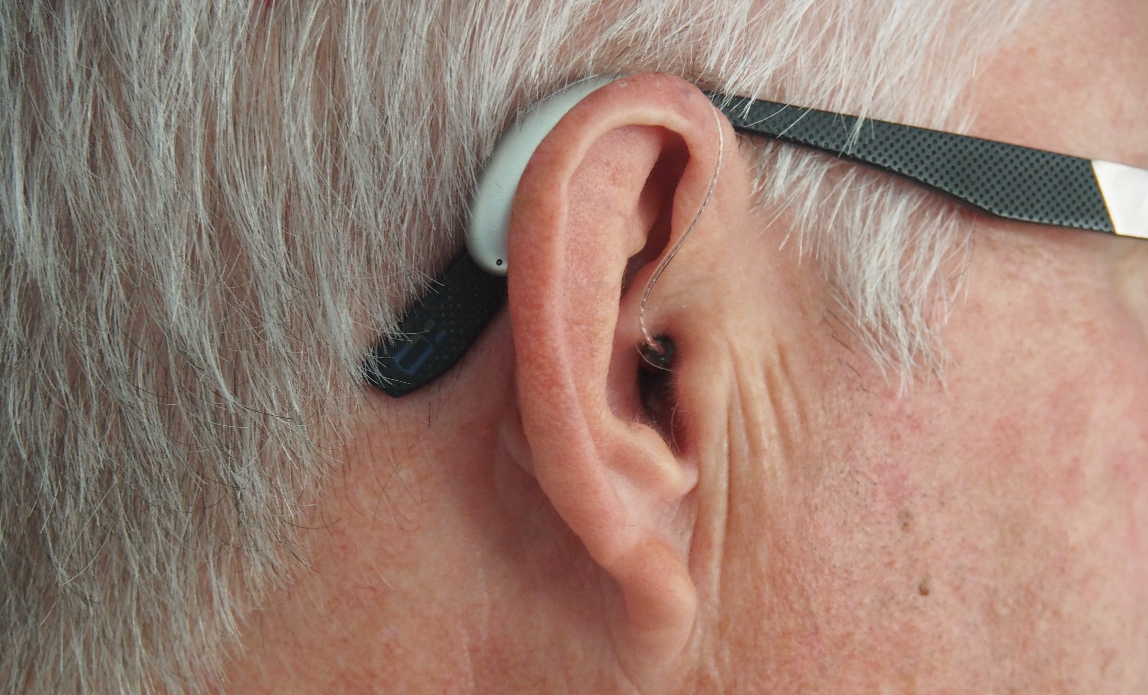 Age-Related Hearing Loss - Vimarsana News