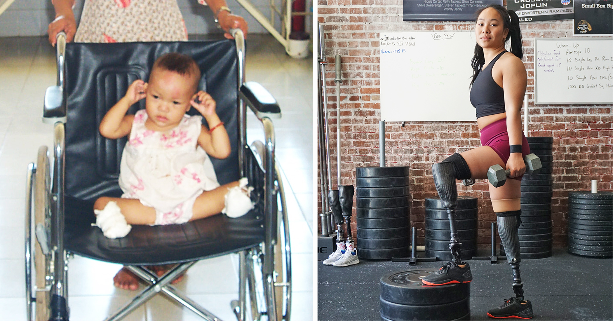 Bomb Survivor Double-Amputee Aims for the 2021 Paralympic Games: 'My Destiny' - Vimarsana News