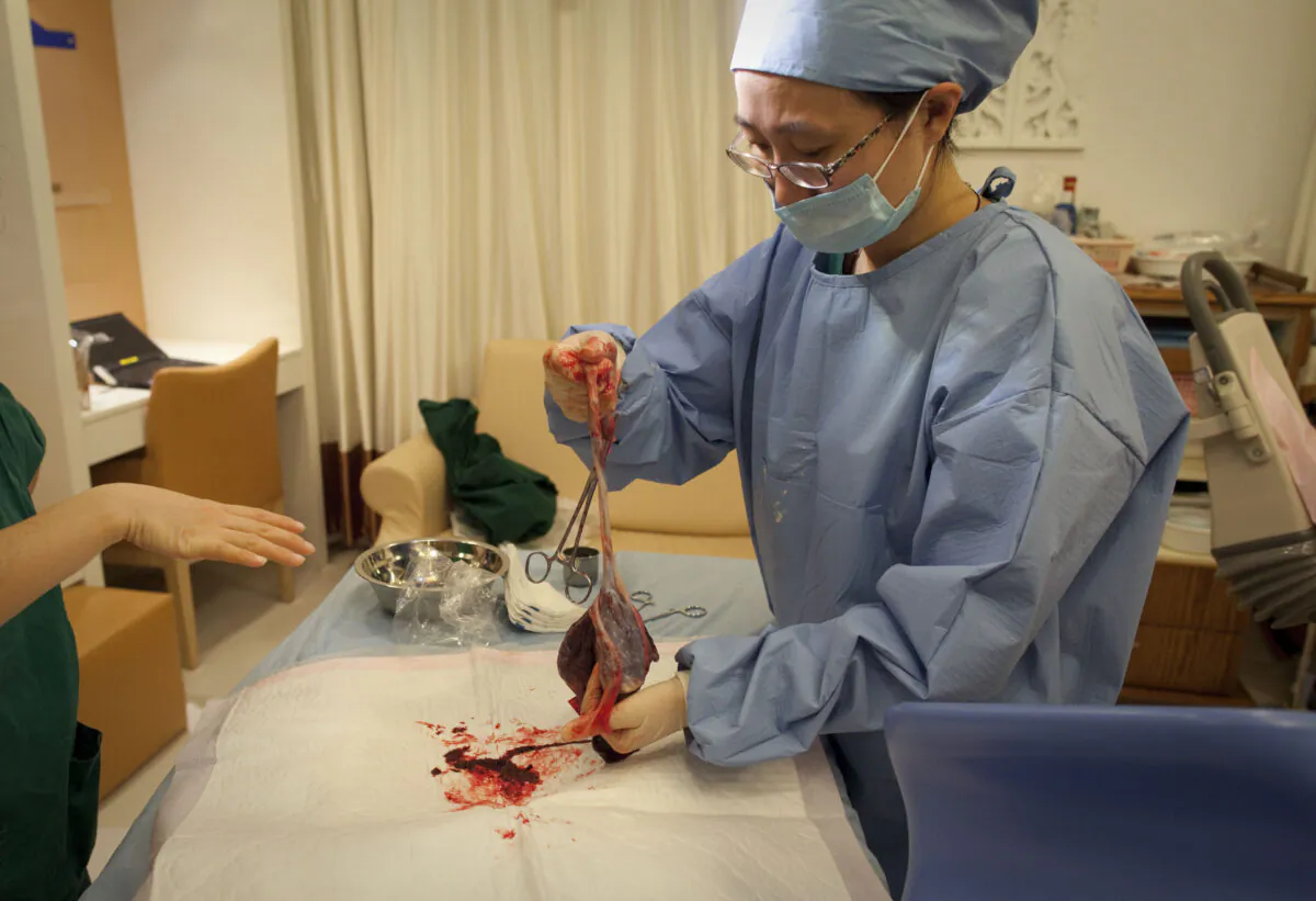 A doctor holds a placenta in the delivery room of a hospital in Beijing, China on Feb. 20, 2012. (Ed Jones/AFP/GettyImages)