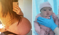 Woman With a Big Bump Which Doctors Thought Would Have Secret Twin Gives Birth to 13lb Baby