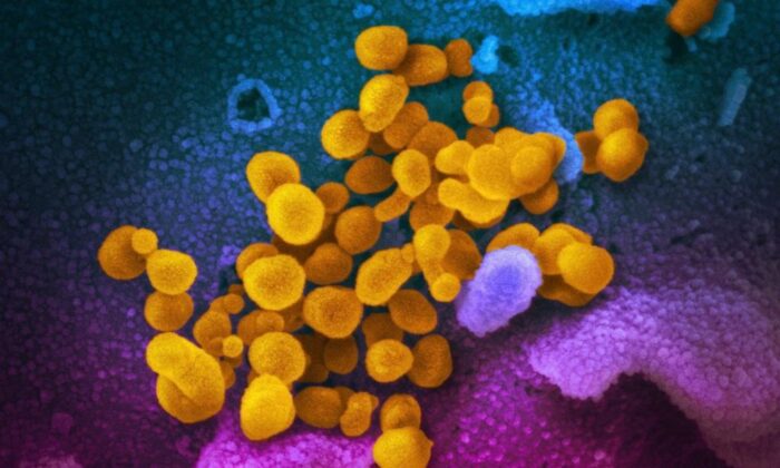 This dateless electron micrograph, made available by the National Institutes of Health in February 2020, shows the new yellow coronavirus SARS-CoV-2 emerging from the surface of cells cultured in the laboratory. I will.  This virus, also known as 2019-nCoV, causes COVID-19.  (NIAID-RML / AP / The Canadian Press)