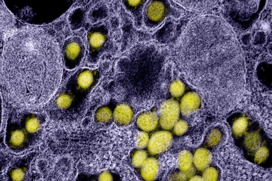 A transmission electron micrograph shows SARS-CoV-2 virus particles isolated from a patient. (NIAID)