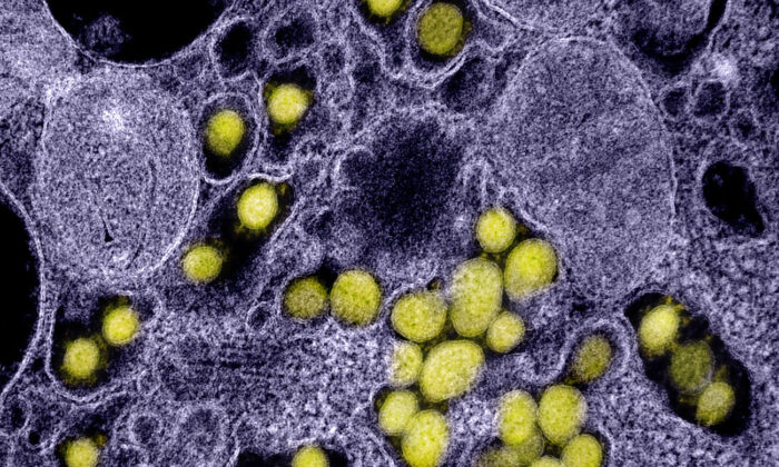 A transmission electron micrograph shows SARS-CoV-2 virus particles, isolated from a patient. (NIAID)
