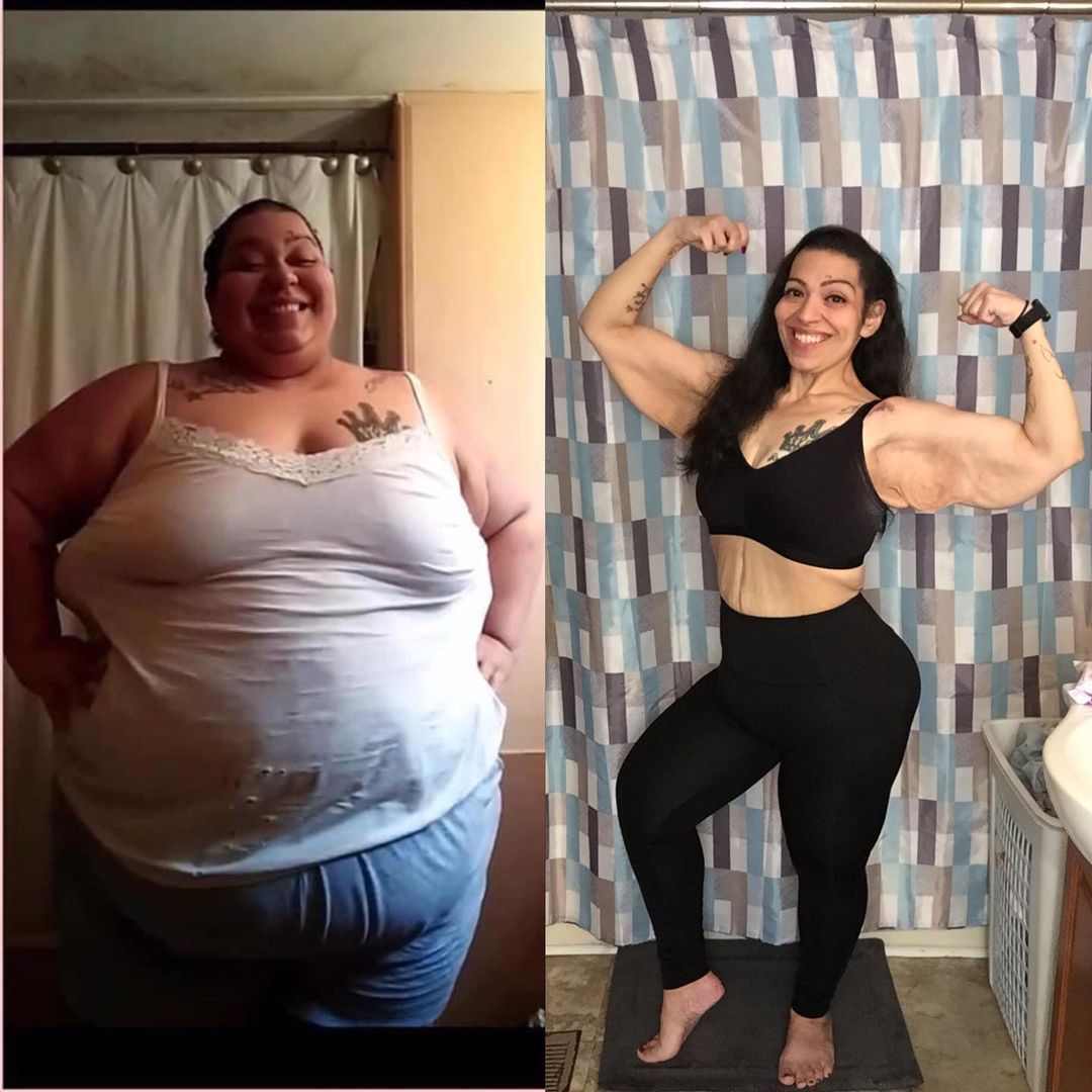 500 Pound Woman Had To Lose 300 Pounds Or Suffer Pain For Rest Of Her Life—and She Did It In 30