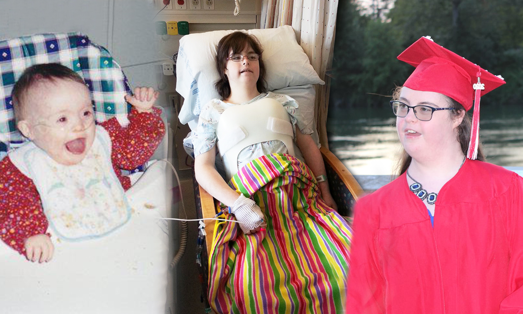 Girl With Down Syndrome, Autism, and Cerebral Palsy Graduates From College, Wins Award - Vimarsana News