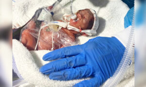 World’s Most Premature Baby Was Given Zero Percent Odds of Survival, He’s Now 1 and Is Thriving