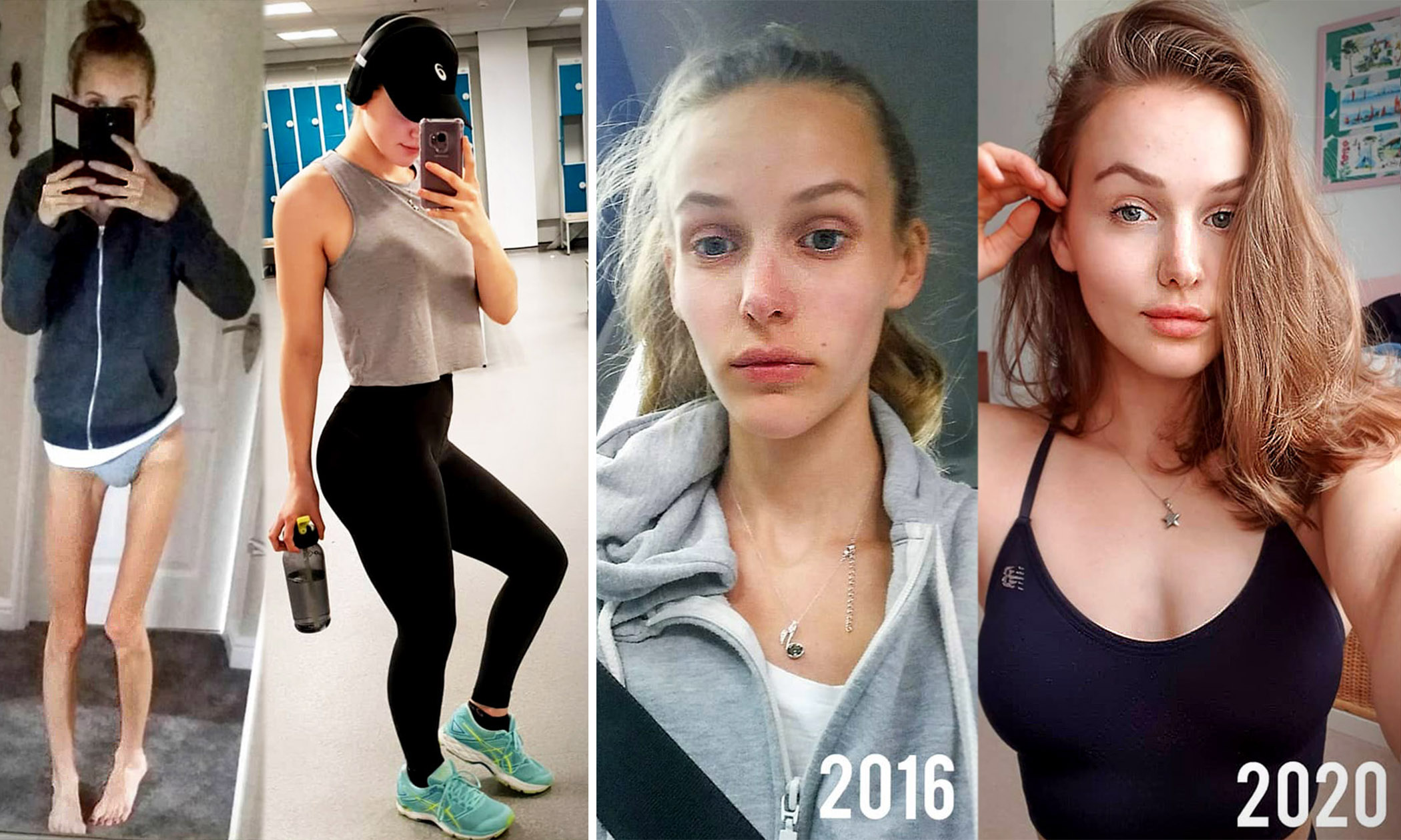 2100px x 1260px - Anorexic Teen Was Rushed to Emergencyâ€“Became Fitness Guru After Making  Incredible Recovery | The Epoch Times