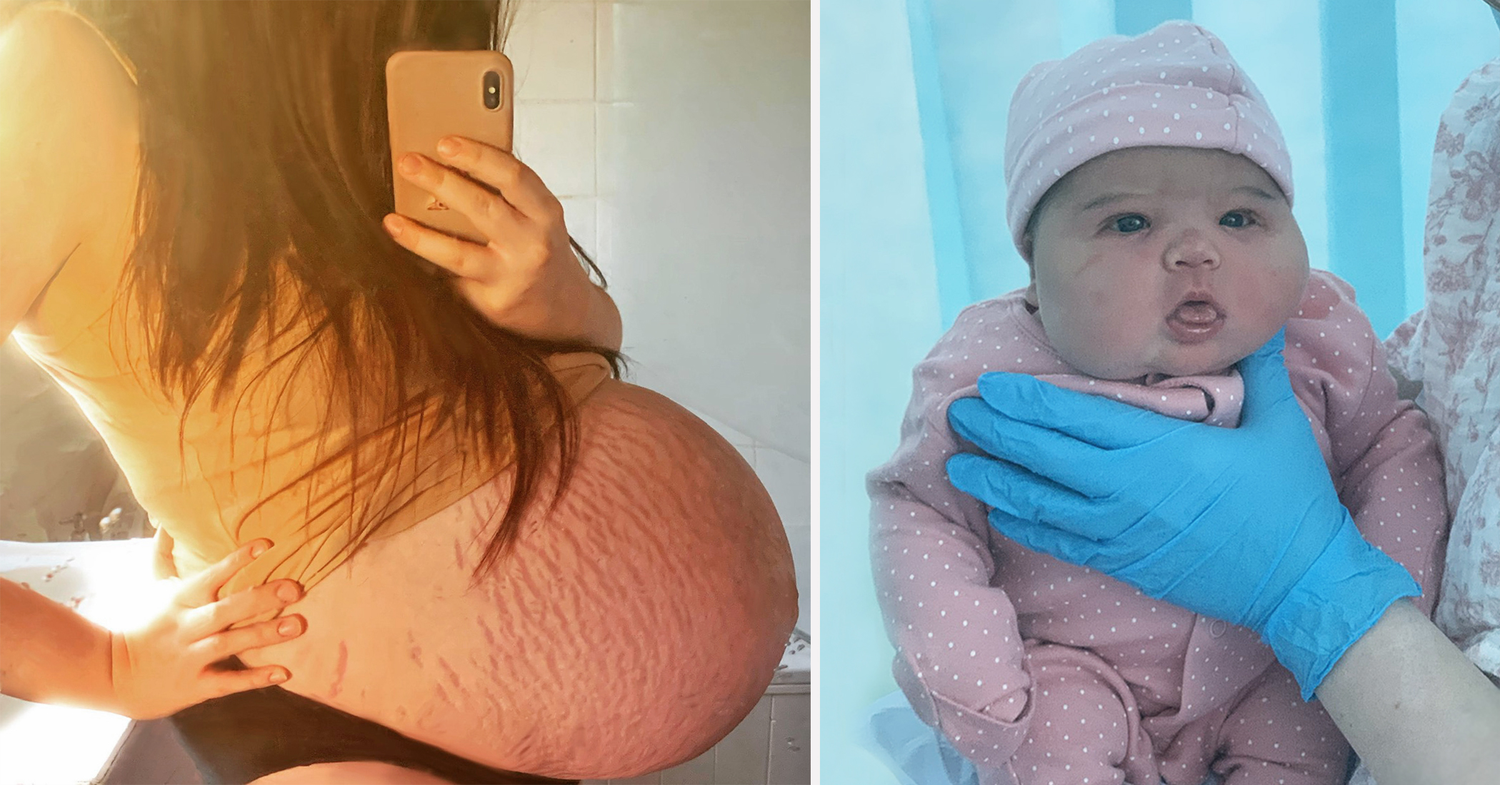 Woman with a big bump which doctors thought would have secret twin gives bi...