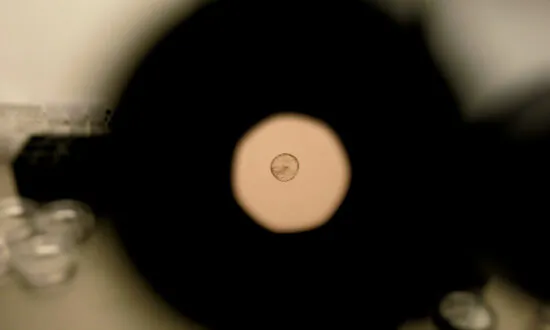 Pushing the Limits on Embryo Research