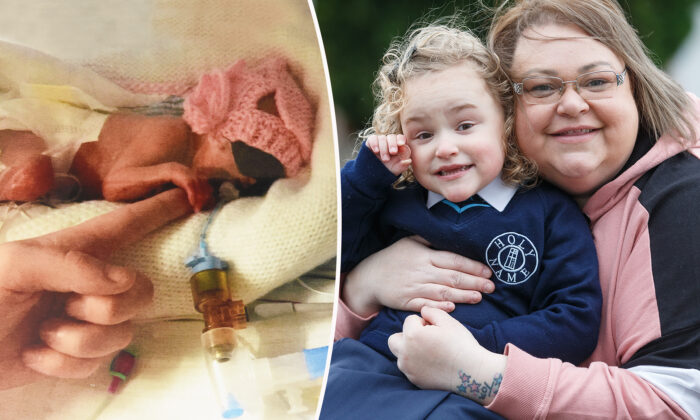 Baby Born With Feet the Size of a Penny Defies Survival Odds: ‘Walking ...