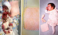 Mom Shares Startling Before and After Photos of Preemie With Favorite Blankie—Now Thriving