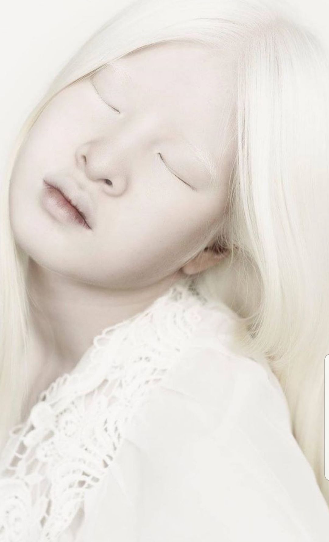 Albino girl who was abandoned by her parents becomes a top model, see photos.