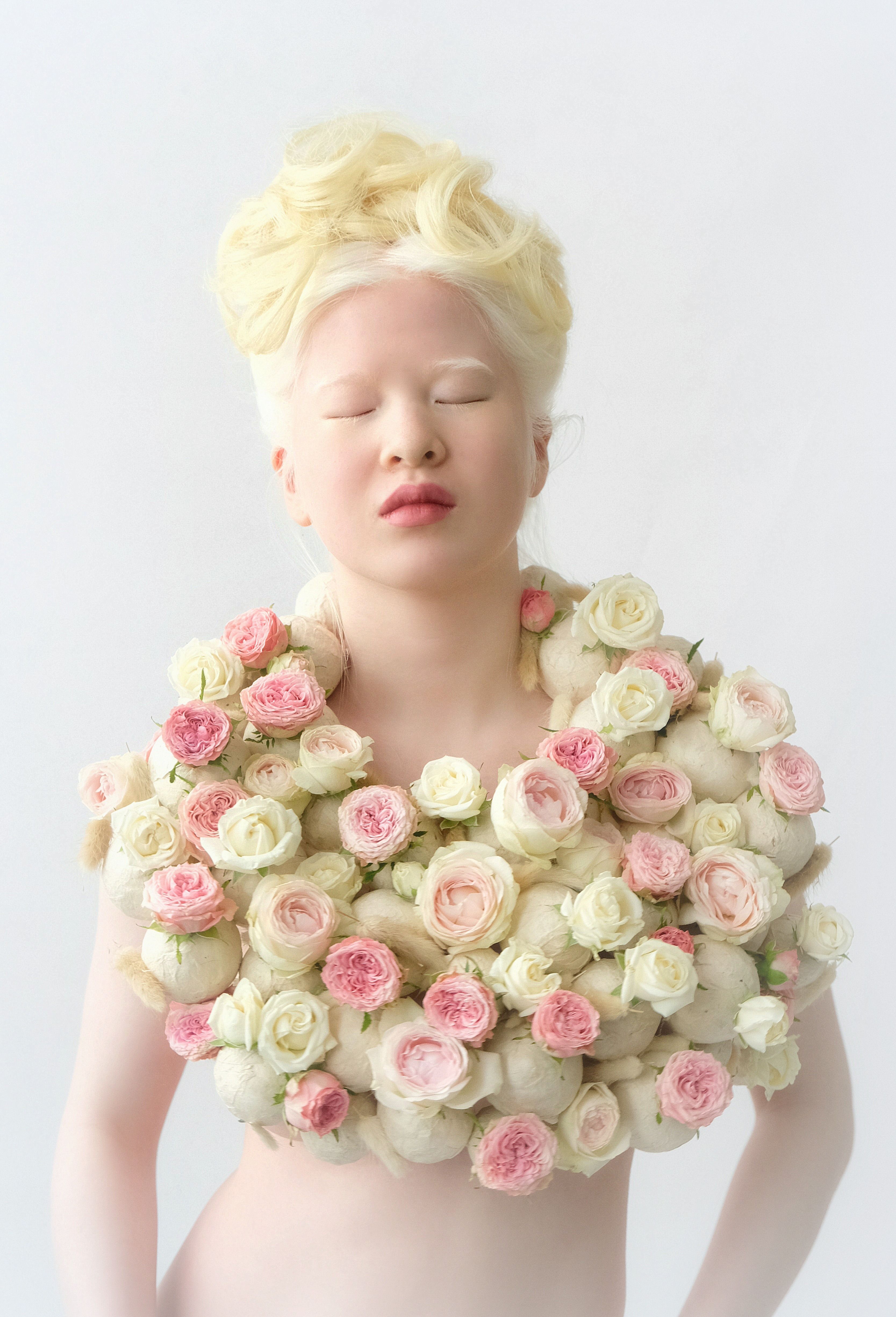 Albino girl who was abandoned by her parents becomes a top model, see photos.