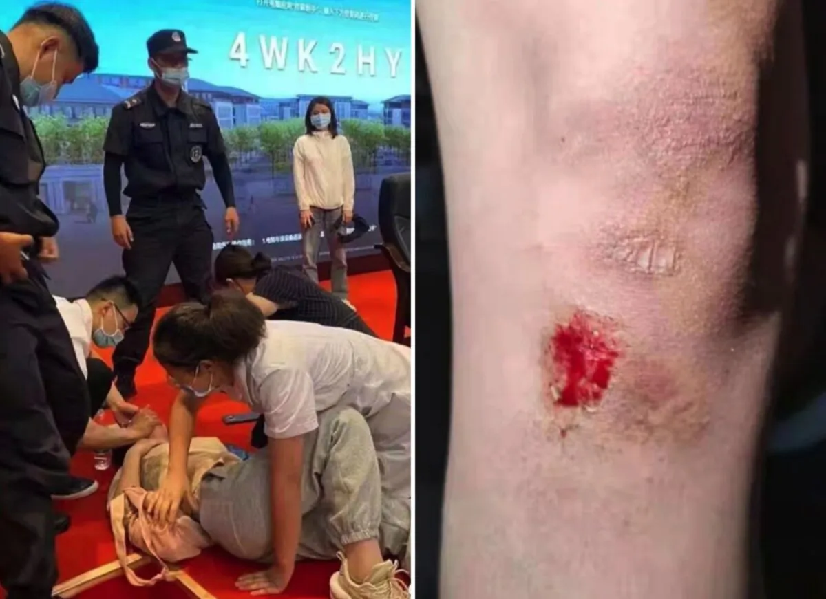 Students were injured at Zhongbei College of Nanjing Normal University in Danyang, eastern China's Jiangsu Province, on June 8, 2021. (Provided to The Epoch Times by interviewee)