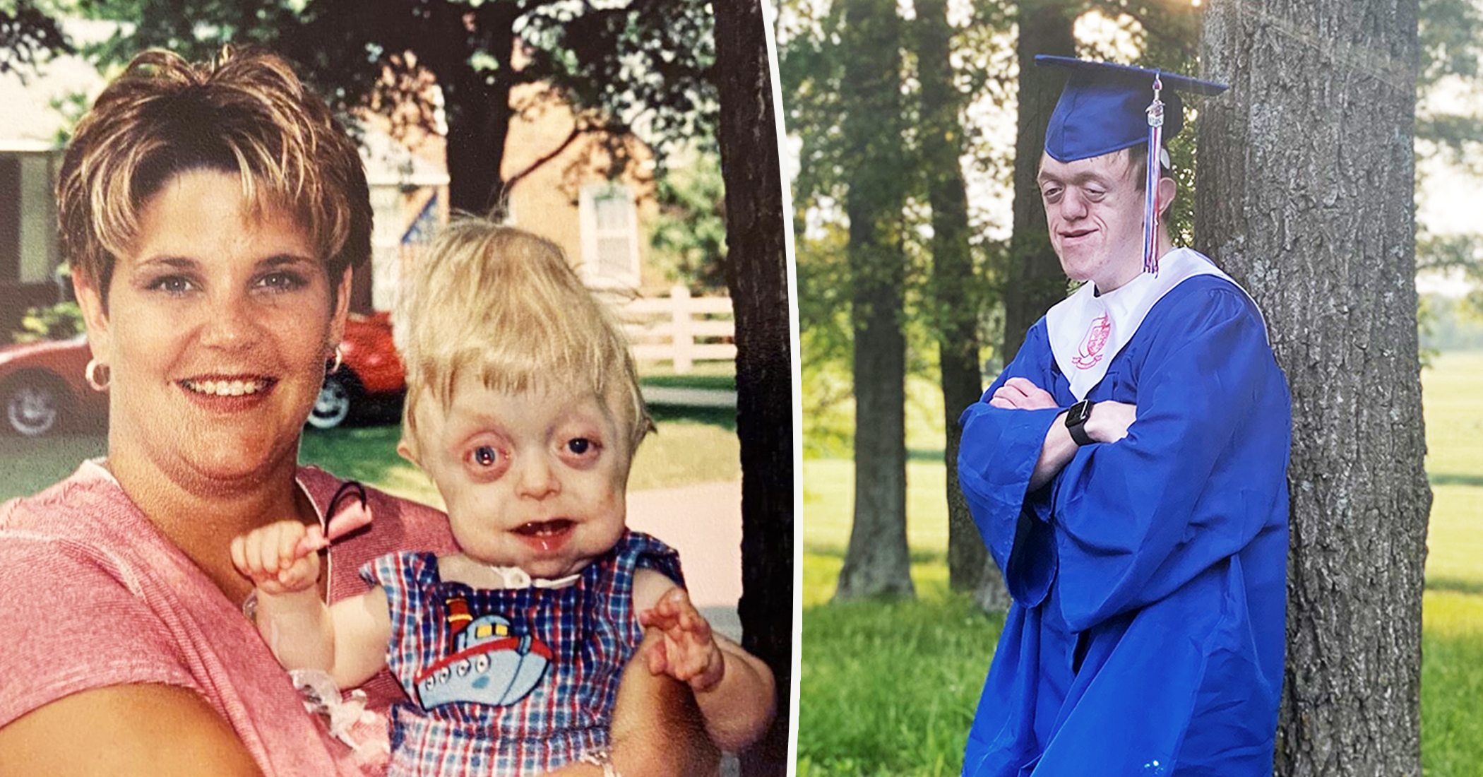 Teen With Rare Disorder Who Wasn't Expected to Live Beyond 18 Months Graduates From High School - Vimarsana News