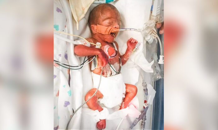 Baby Born Size Of Sharpie Defies Incredible Odds Of Survival 4 5 Months Later He S A 7 Pound Miracle