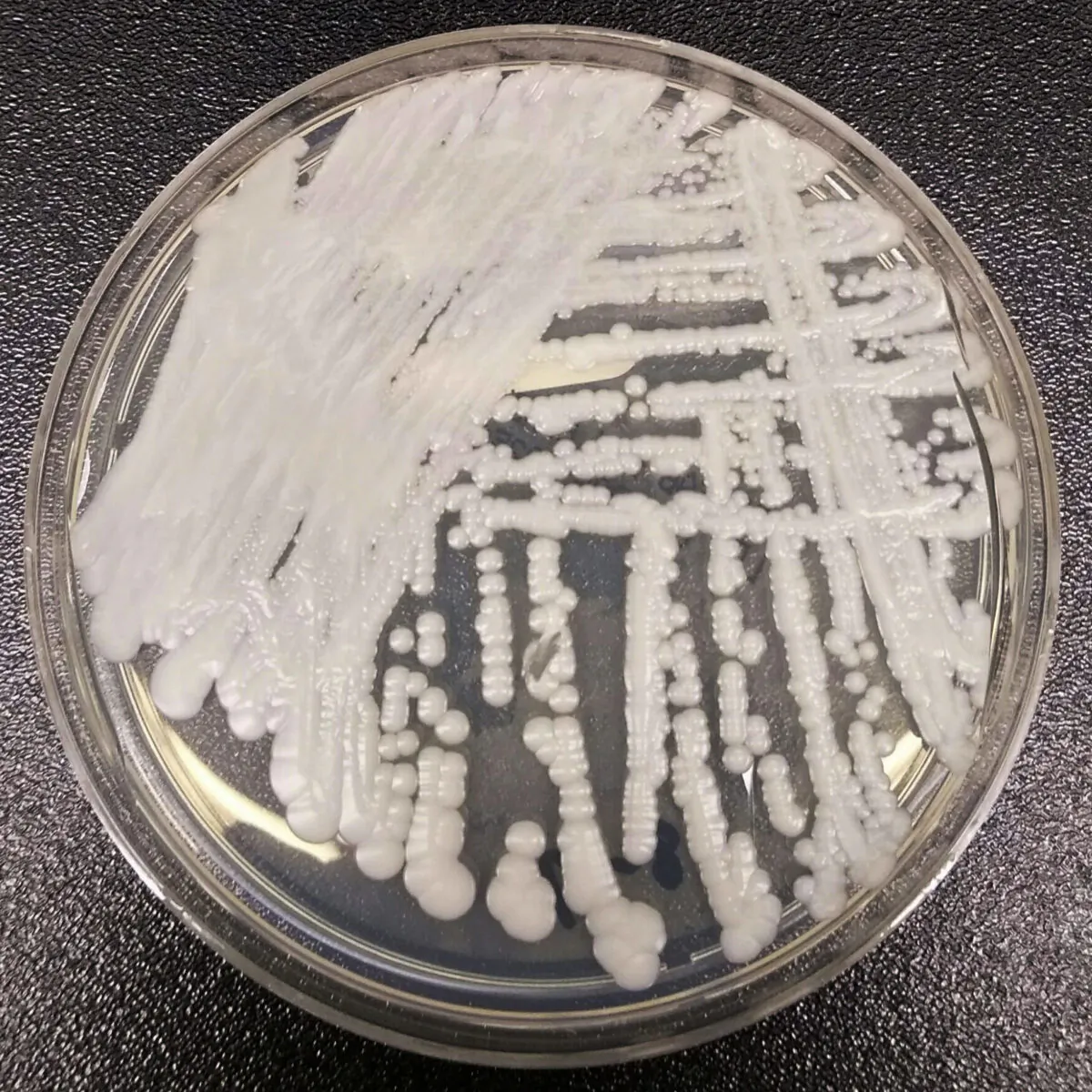 A strain of Candida auris cultured in a petri dish at a CDC laboratory in 2016. (Shawn Lockhart/CDC via AP)