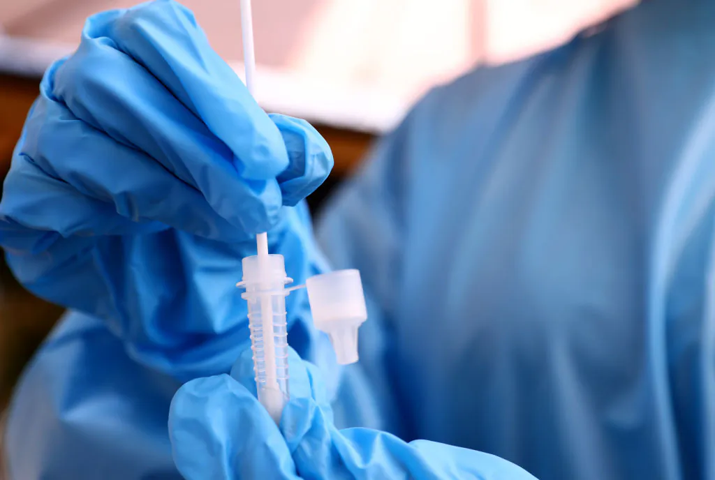 A registered nurse stirs a nasal swab in testing solution after administering a COVID-19 test at Sameday Testing in Los Angeles on July 14, 2021. (Mario Tama/Getty Images)