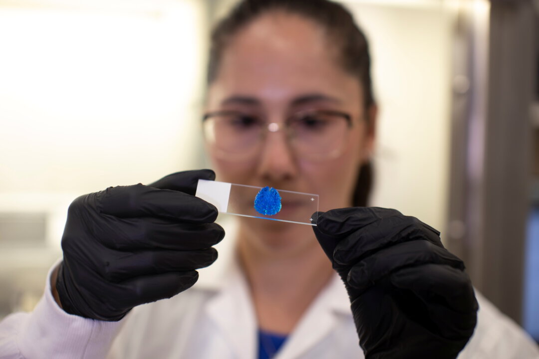 Israeli researcher Lena Neufeld examines a 3D model of a malignant tumor, as part of a brain cancer research that uses patients' cells to make 3D printed models of tumors, at Tel Aviv University, Israel, on Aug. 17, 2021. (Nir Elias/Reuters)