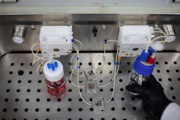 3D Tumour blood
