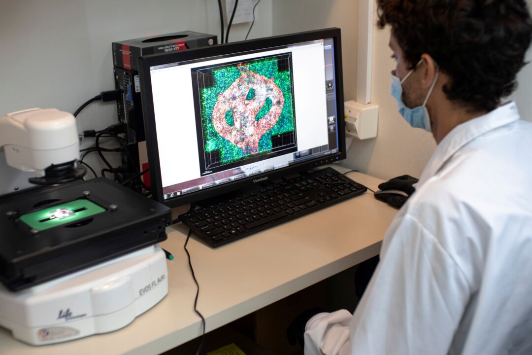 Israeli researcher Eilam Yeini examines a microscope image of a blood vessel tube surrounded by cancer tissues, as part of a brain cancer research that uses patients' cells to make 3D printed models of tumors, at Tel Aviv University, Israel, on Aug. 17, 2021. (Nir Elias/Reuters)